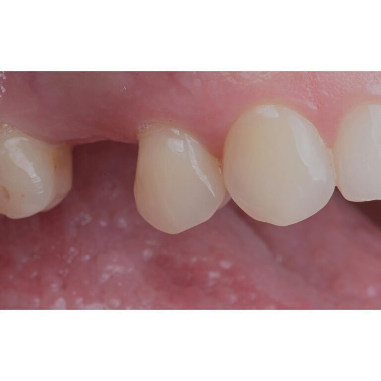 sbi_17899288298930117