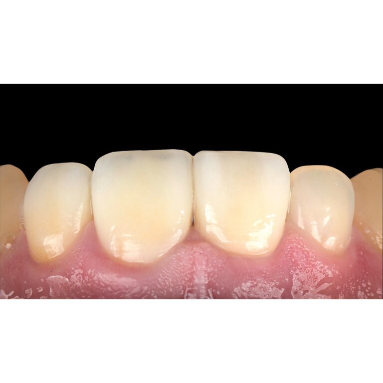 sbi_18223283902302225